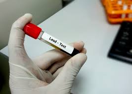 Known to Be Toxic for a Century, Lead Still Poisons Thousands of Midwestern Kids